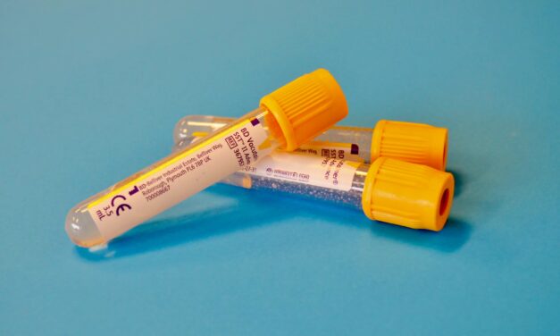 CHPG faces critical blood shortage amid summer donation decline